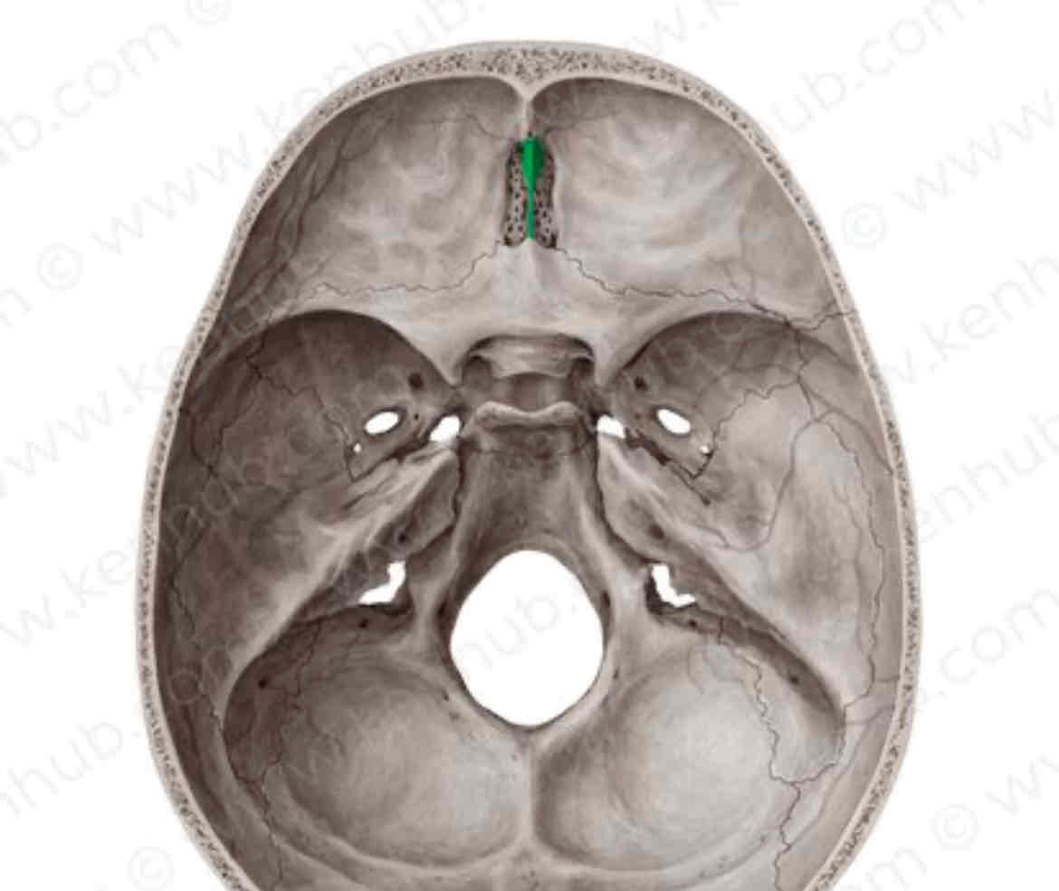 knowt flashcard image