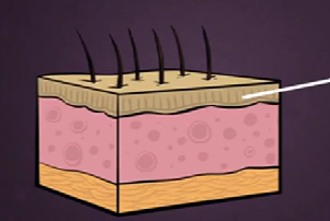 <p>Epidermis-</p>