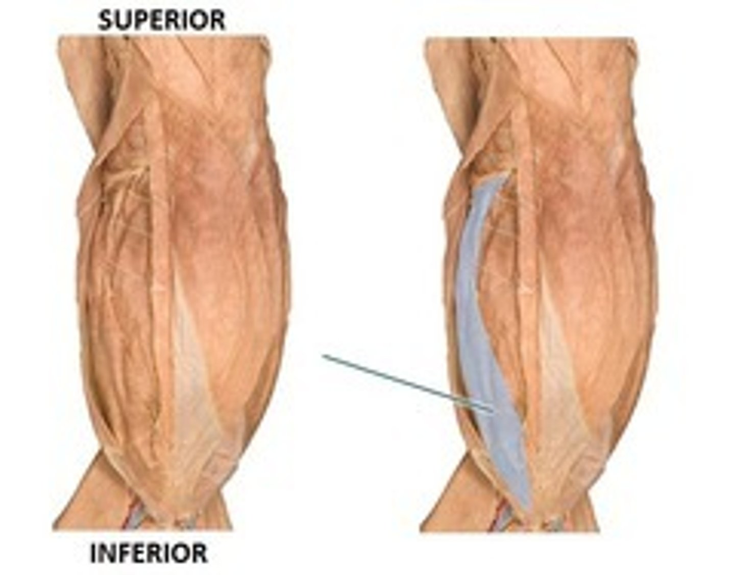<p>-under external oblique</p><p>- origin - dorsal lumbar</p><p>-insertion- Linea alba with the external oblique</p><p>- function : compresses the abdominal region</p>