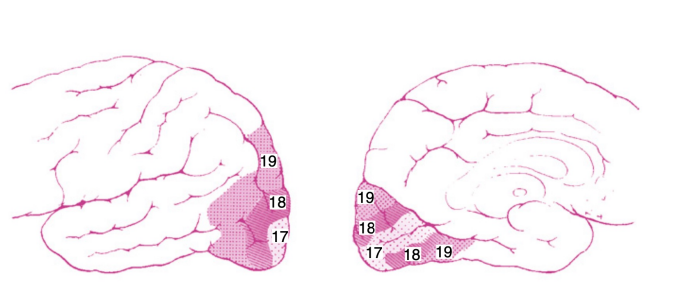 <p></p><p>Information transmitted to extrastraite cortex (higher visual association areas) provide further interpretation </p><p>These areas surround<strong> V1</strong> located on the<strong> lateral aspects of the occipital cortex </strong></p><p><strong>V2-V5</strong>; previously Brodmann <strong>18-19 </strong></p><p>Visual and visual association areas in one hemisphere are connected to the corresponding areas in the other hemisphere through the<strong> posterior portion of the corpus callosum </strong></p><p>Information about <strong>stimulus orientation</strong>, <strong>movement direction</strong>, <strong>binocularity </strong>are all constructed in<strong> V1</strong></p>