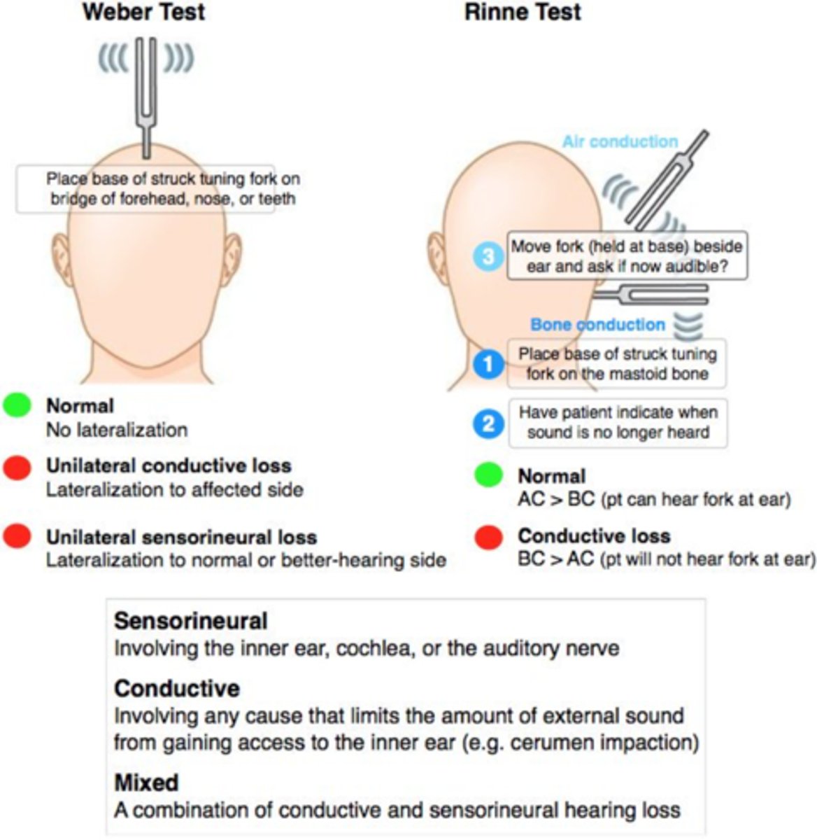 <p>Rinne test: tuning fork on mastoid, then near ear</p><p>Weber test: tuning fork on top of head, then near ear</p><p>Normal: AC &gt; BC in both ears</p><p>Abnormal Rinne test</p><p>• Right bone conduction problem =&gt; BC &gt; AC on right (lateralization to right side)</p><p>• Left neural problem =&gt; AC &gt; BC on both sides (lateralize to right side)</p><p>REMEMBER WITH WEBER TEST THE SOUND SHOULD NOT LATERALISE ! (if it does it means you either have sensorineural in other ear or conductive in that ear) </p>