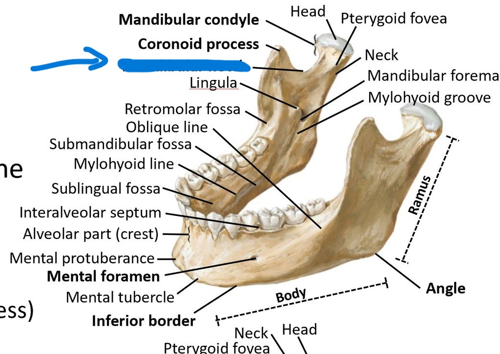 <p>What part of the mandible?</p>