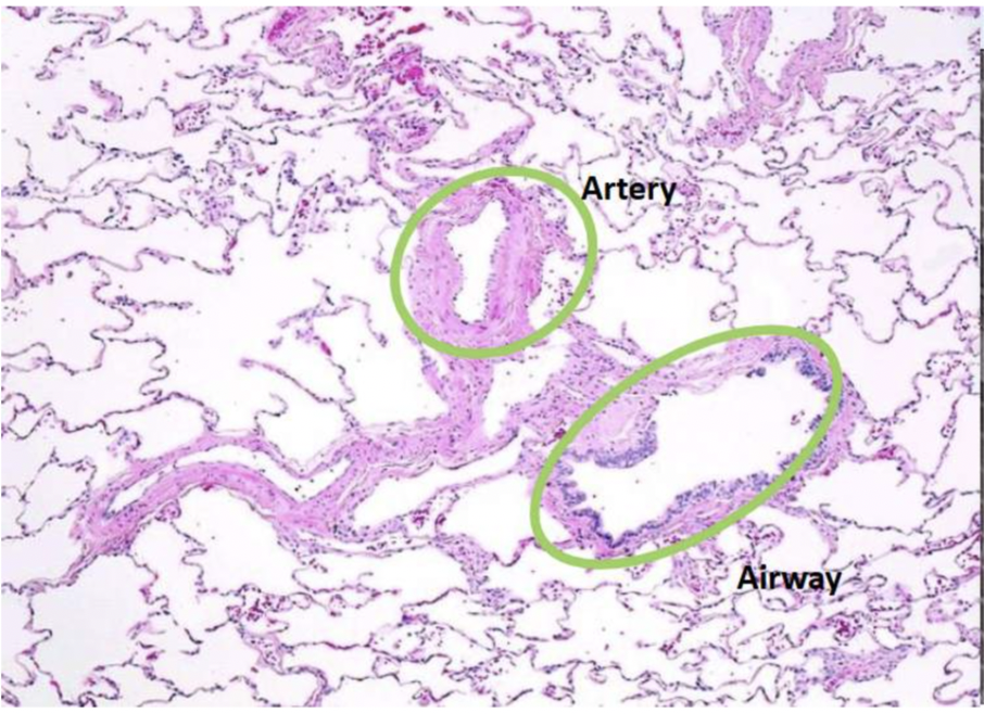 <ol><li><p>Airways have more visible epithelial lining than artery endothelium </p></li><li><p>Surrounding smooth muscle tissue is thicker relative to lumen than airway </p></li></ol><p></p>
