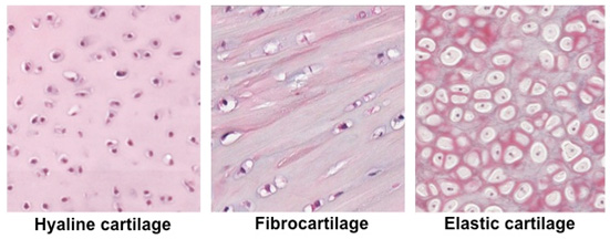 <p>Composed of a mixture of dense collagen fibers and cartilaginous tissue (hyaline). </p><p>→ always found near hyaline cartilage and will gradually merge into it.</p><p>→ Cells are enclosed in capsules of matrix giving it great tensile strength</p><p>fx: serves as shock absorber and protective cushion</p><p>Location: intervertebral discs, between bones in pelvic girdle, and TMJ  </p>