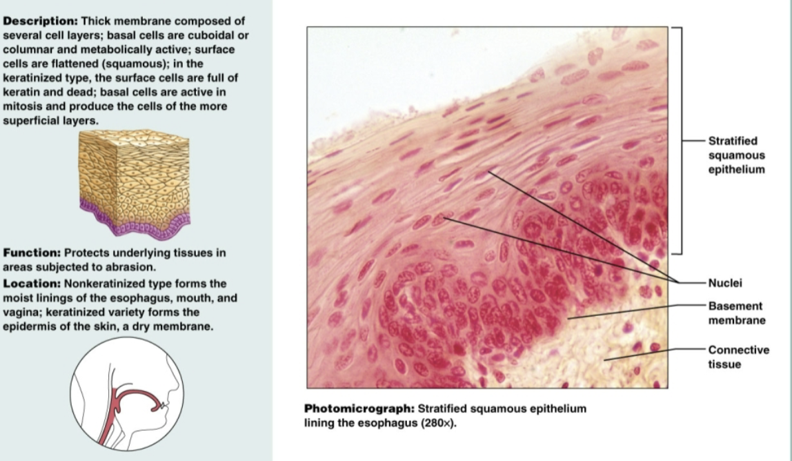 <p>multiple layers of flat, sheet-like cells that serve as protection for underlying tissues in areas subjected to abrasion. Non-keratinized types form moist linings of the esophagus, mouth, and vagina. Keratinized forms the epidermis of the skin</p>