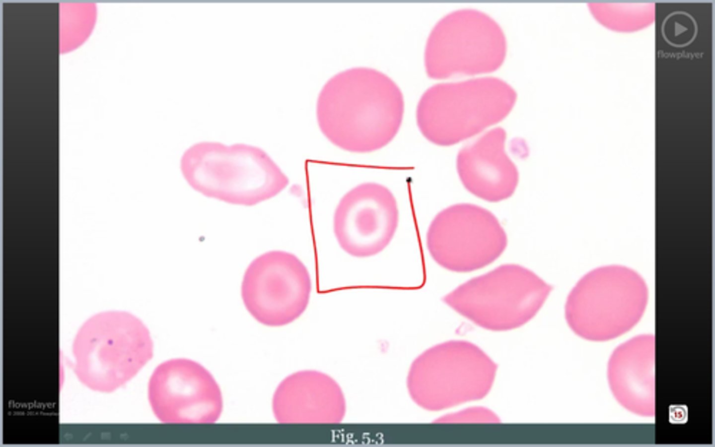 <p>name the cell; found in what Dz's</p>