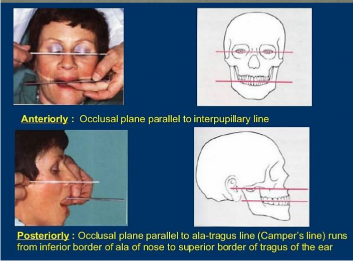 <p>connect ala of nose (wing like structure) to the tragus of the ear (small cartilage in front of ear canal)</p>
