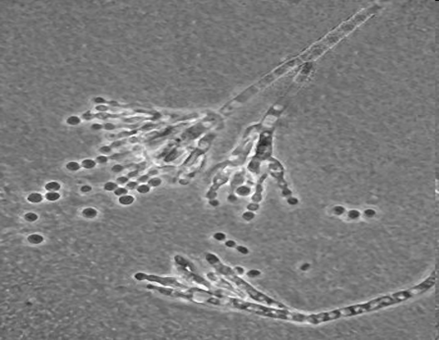 <p>looks like a brush (structures arise from each/ branching), not overly broad</p>