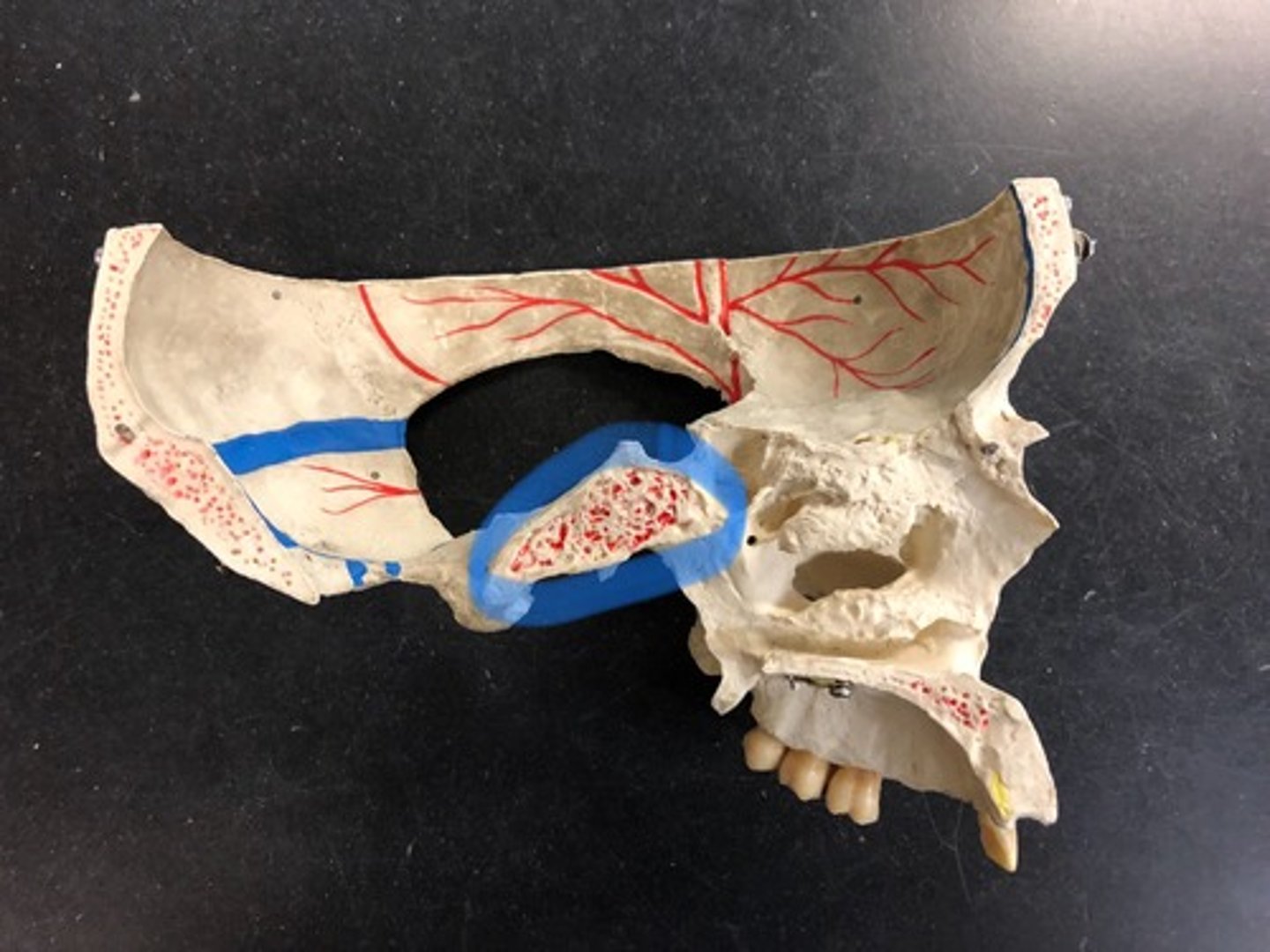 <p>Red dots deep to sphenoid</p>