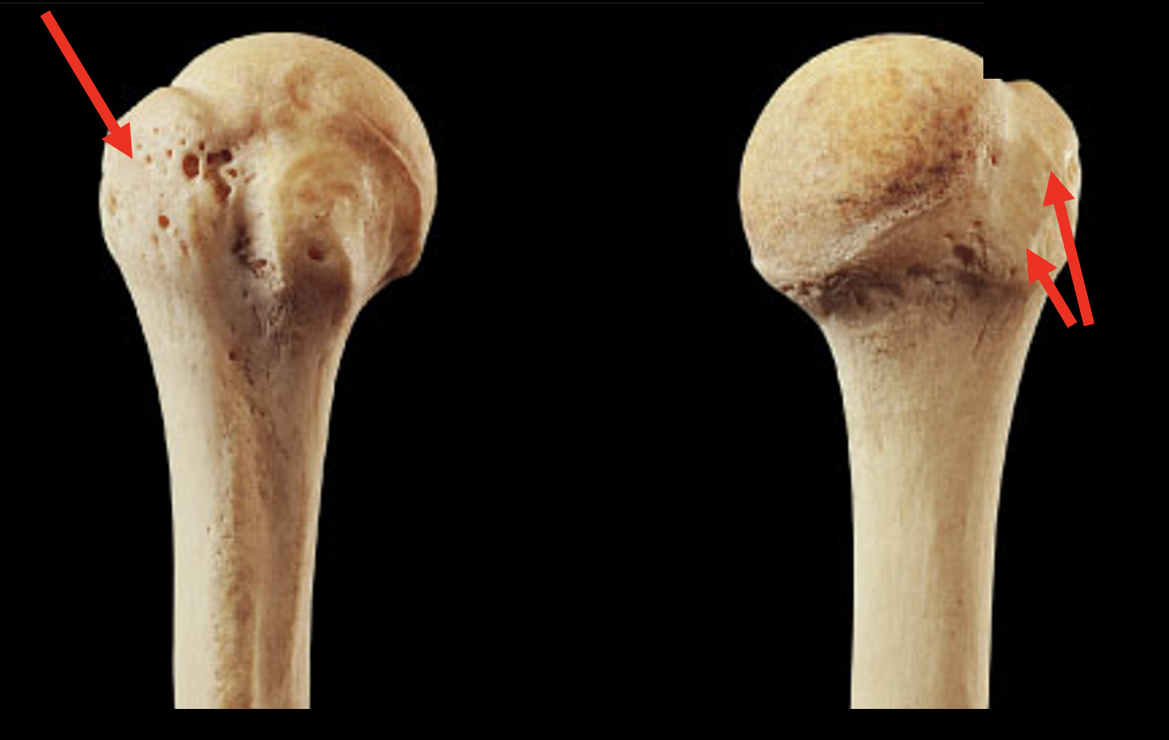 <p>Name this region of the humerus</p>