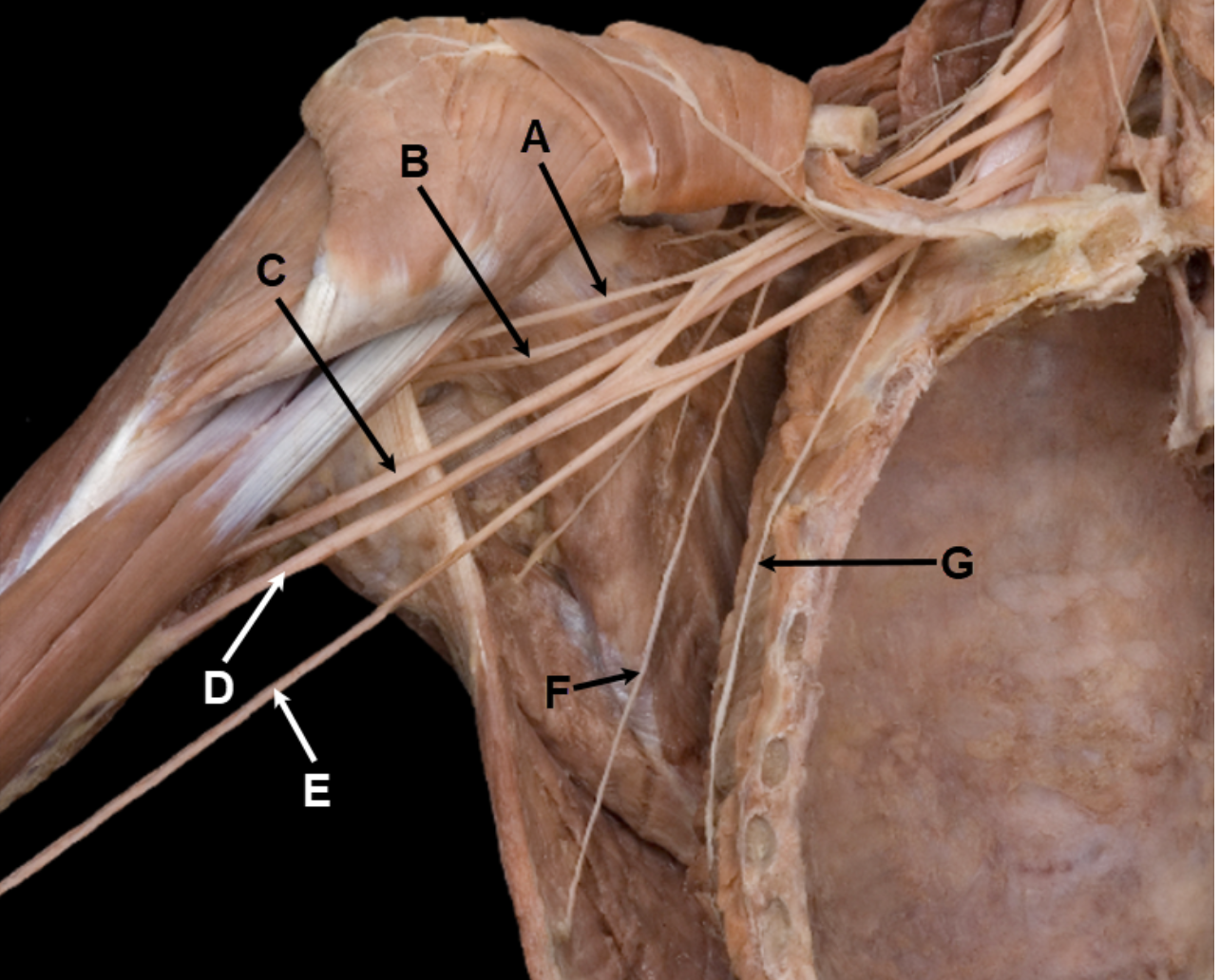 <p><span><span>In the image above, identify nerves A-G.</span></span></p>