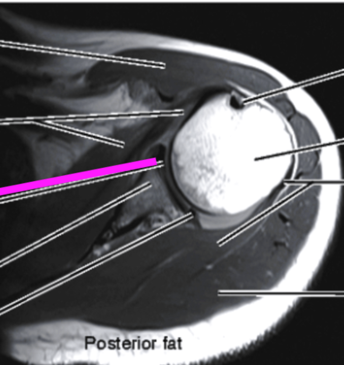 <p>what does the pink line point to?</p>