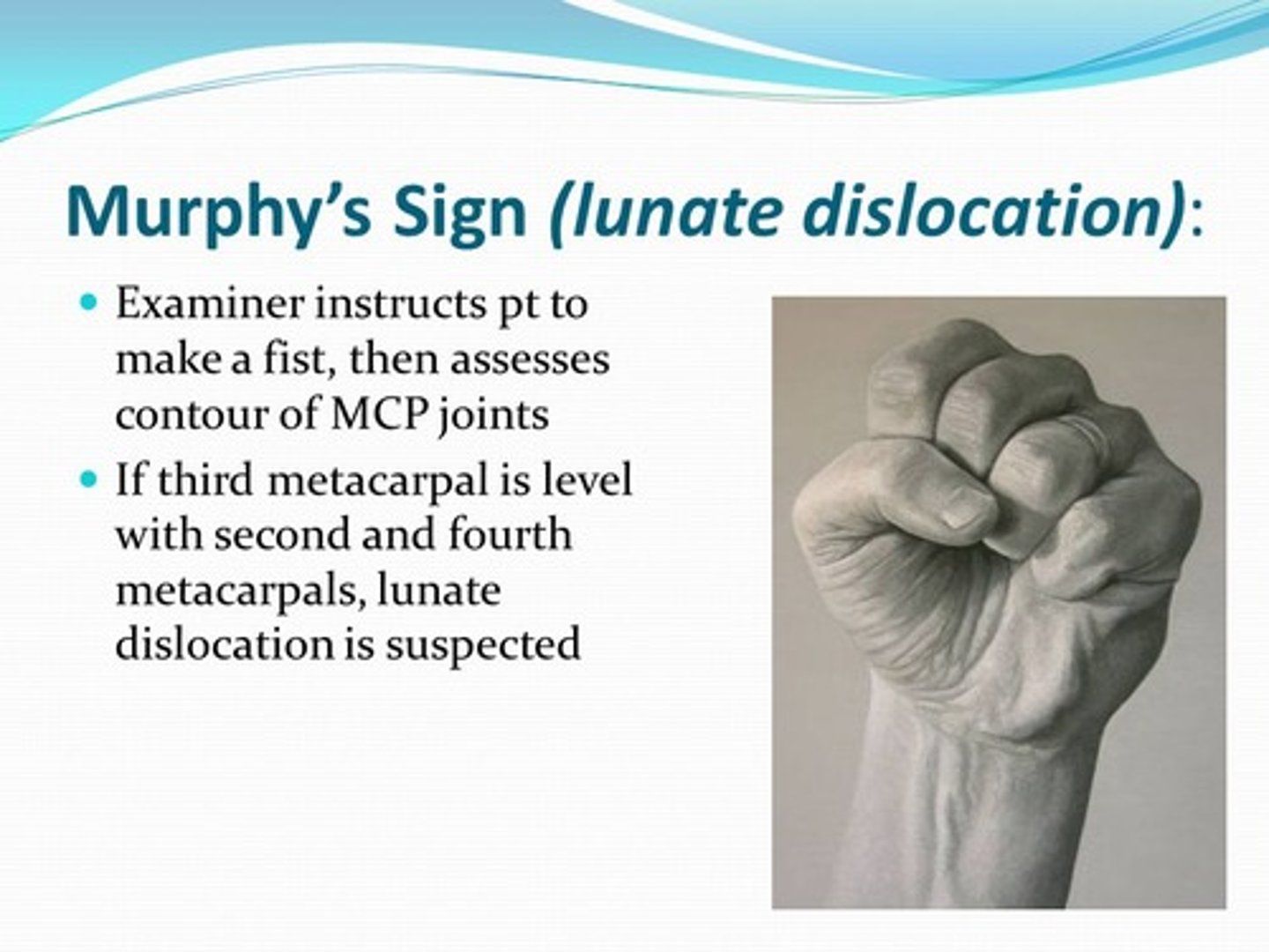 <p>3rd MCP head appears same height as others in a fist</p>