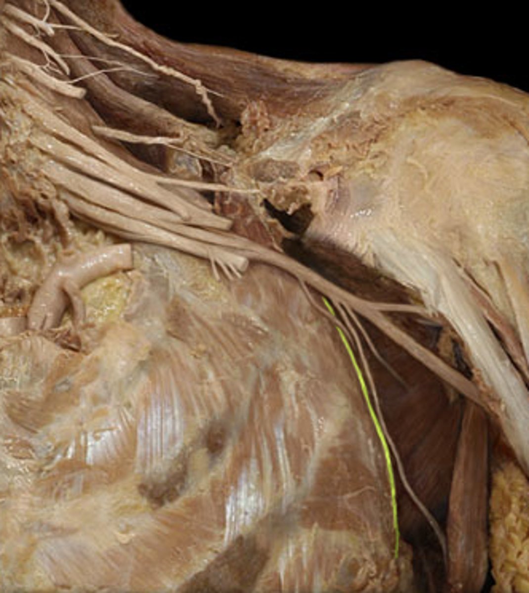 <p>What is this nerve?</p>
