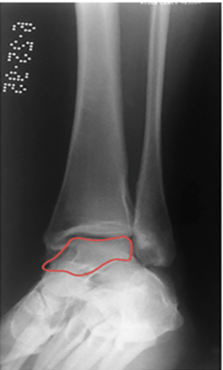 <p>What structure is highlighted?</p>