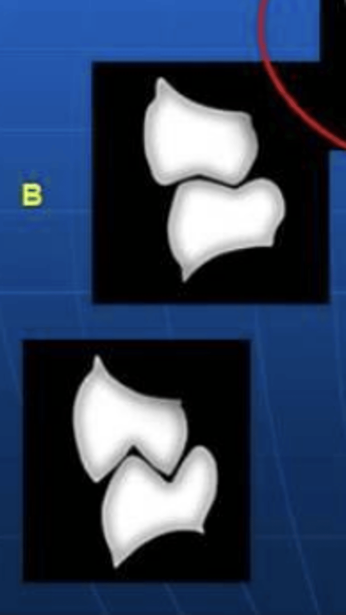 <p>what type of teeth</p>