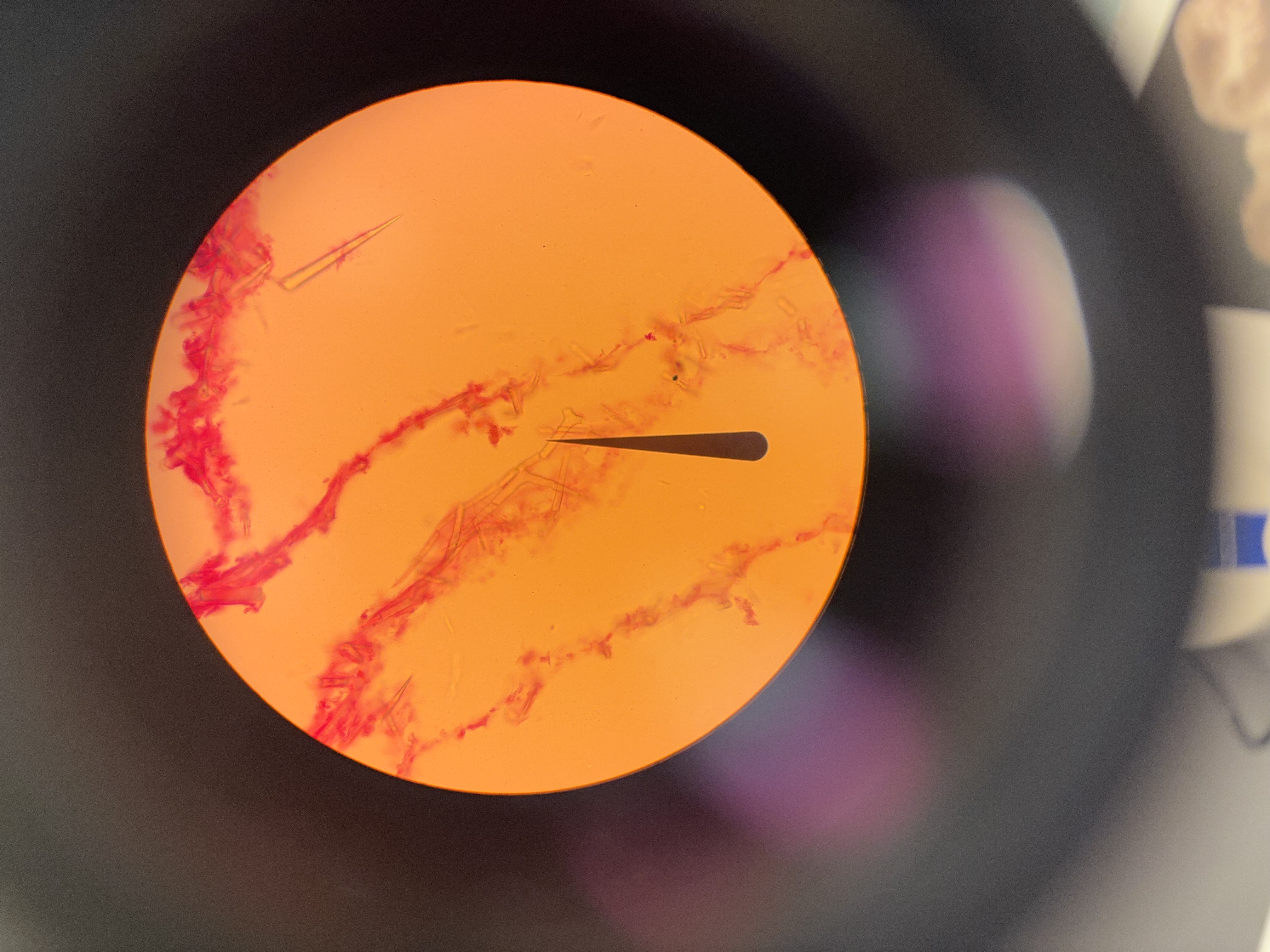 <p>spicles are calcerous </p><p>asconoid, syconoid, or leucnoid</p>