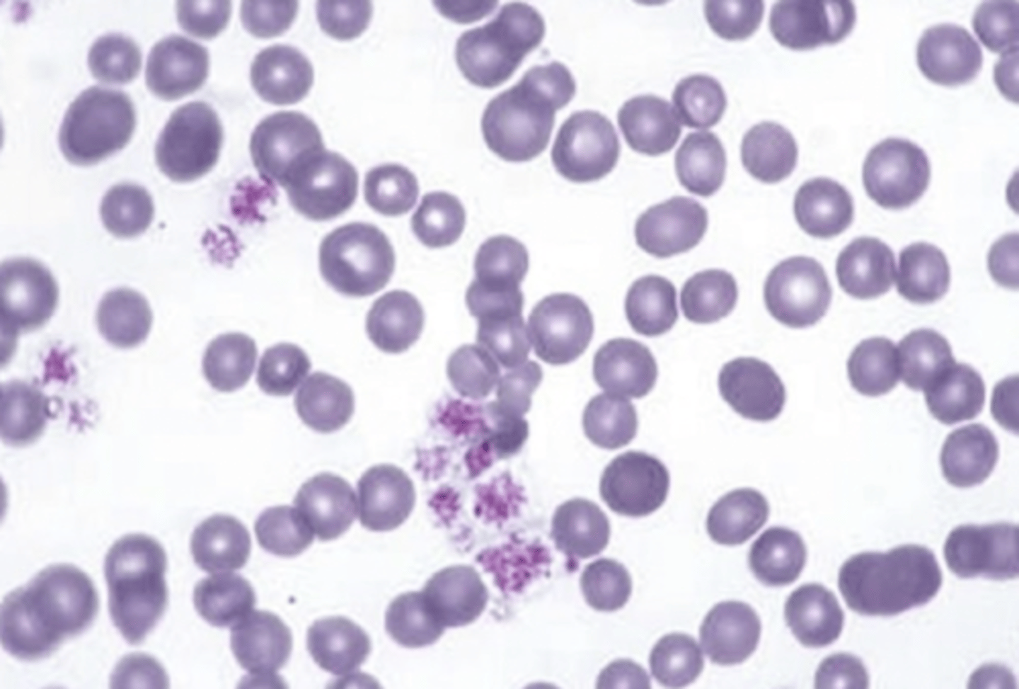 <p>nonregenerative or regenerative? why?</p>