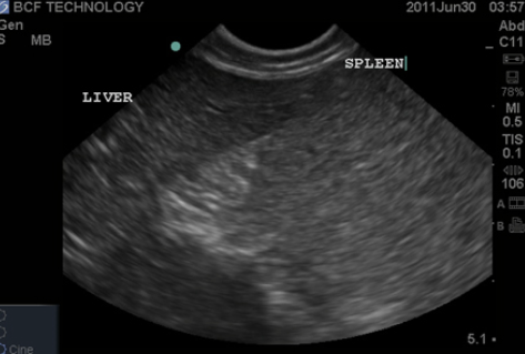 <ul><li><p>spleen is hyperechoic to liver</p></li><li><p>liver is hyperechoic (or isochoeic) to renal cortex</p></li><li><p>renal cortex is hyperechoic to renal medulla</p></li></ul><p></p>