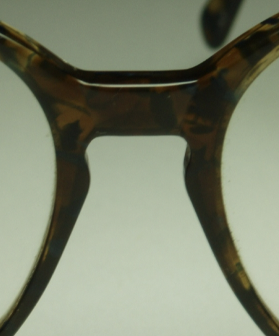 <p>keyhole appearnce- designed to take weight off nose</p>