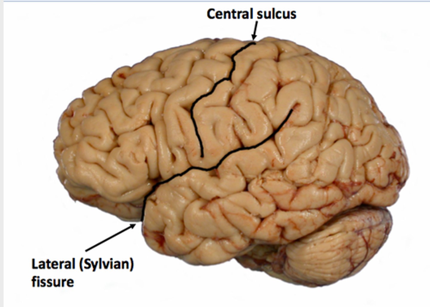 <p>separates frontal & parietal from temporal lobes</p>