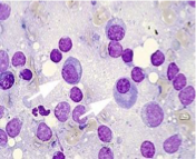 <p>What connective tissue cell is shown in the following image?</p>