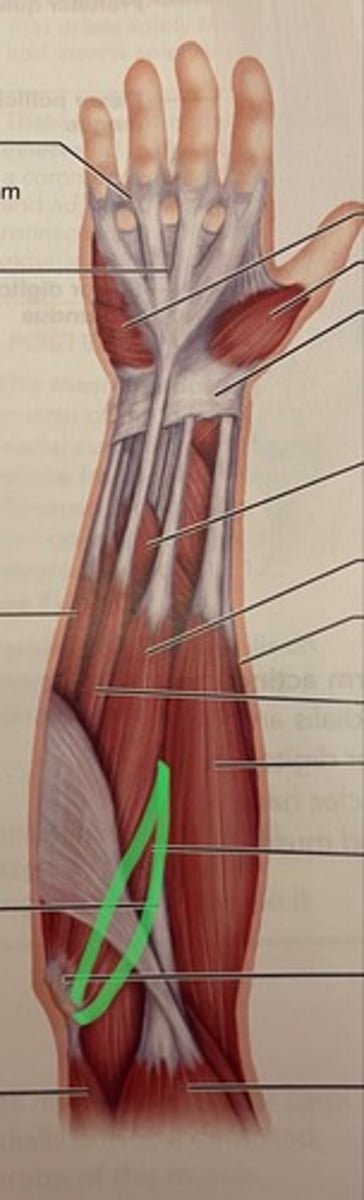 <p>O: ulna</p><p>I: radius</p><p>A: pronates forearm</p>