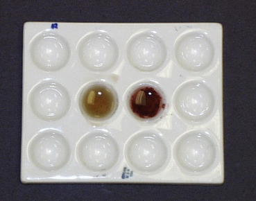 <p>well on right is positive</p>