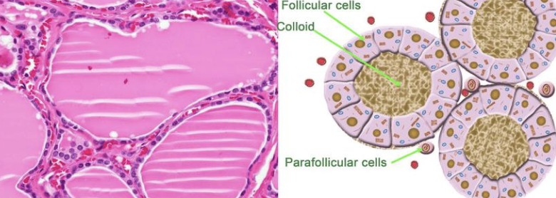 <p>majority of tumors associated with clinical signs are malignant</p><p>benign adenomas are generally small, noninvasive, and clinically silent </p>