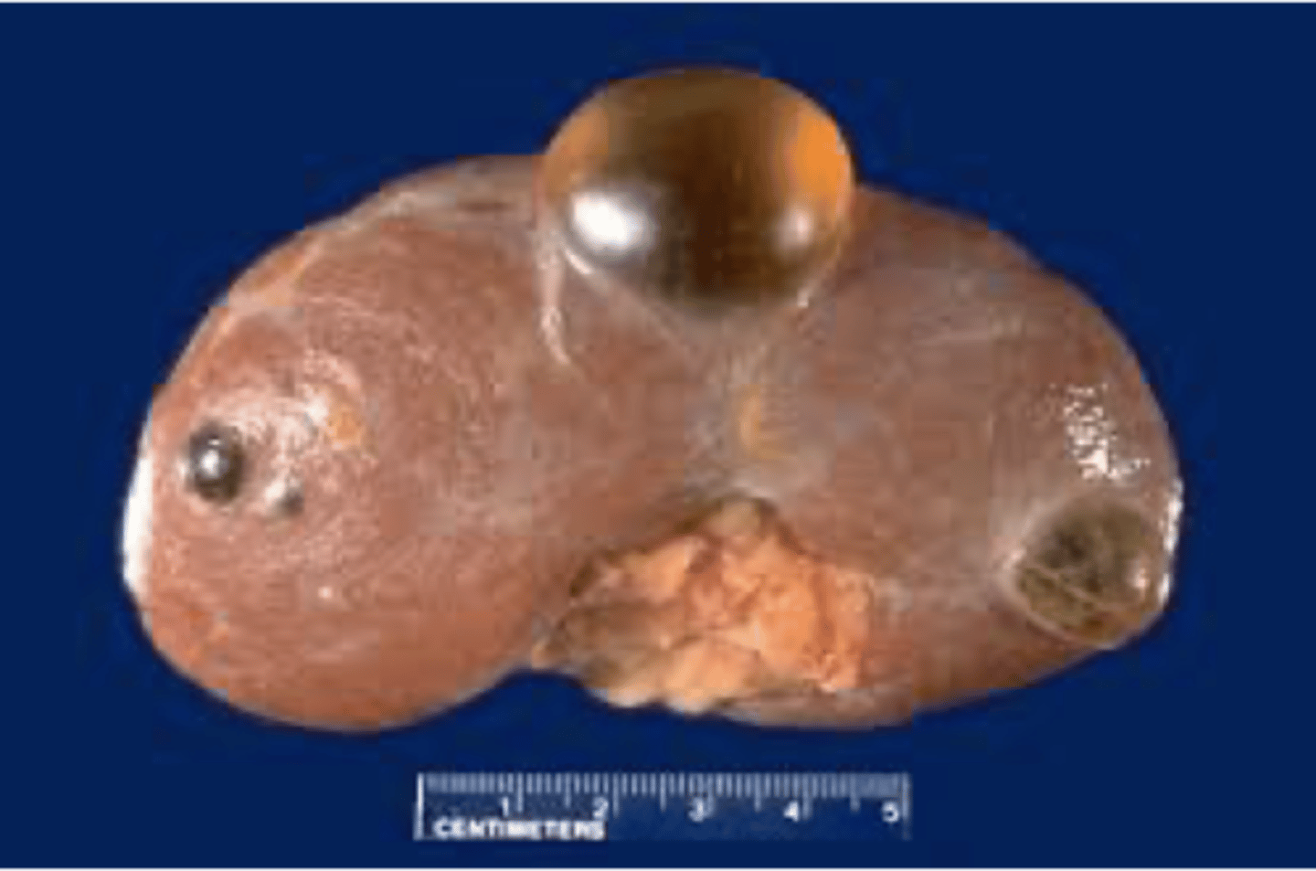 <p>ID</p>