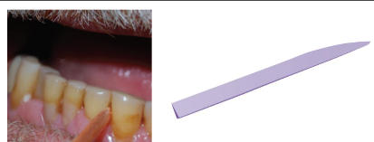 <p><strong>• Round toothpicks</strong></p><p><strong>• High risk for gingival trauma</strong></p><p><strong>Can be used for periodontitis patients (at and under margin, interdental, furcation and concaves)  and orthodontic patients (remove biofilm at gingival margin above bands) </strong></p>