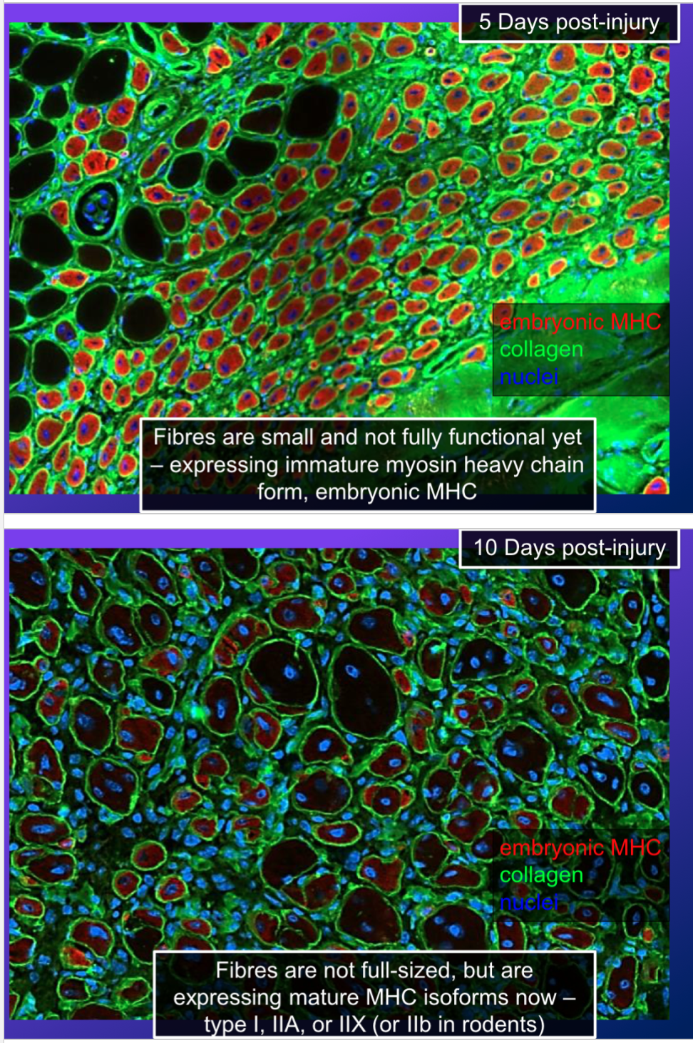 <p>-at 5 days post injury, they stained for embryonic MHC, collagen, and nuclei</p><ul><li><p>there were a lot of newly formed cells that are not functional yet, and they all have central nuclei and express immature myosin heavy chain form, which is the embryonic MHC from the satellite cells =&gt; can still differentiate into every type of muscle fibre</p></li></ul><p>-at 10 days post injury, the fibres are still not full sized and have central nuclei, but but the embryonic MHC no longer stains, so the cells express mature MHC isoforms now (type 1, 2a, or 2x)</p>