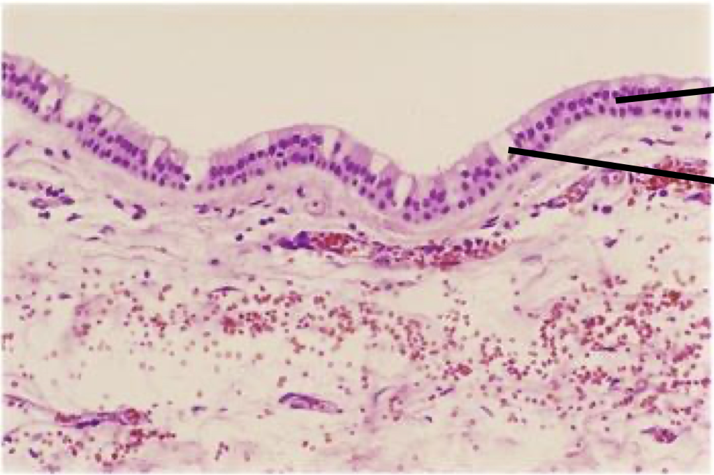 <p>Label top to bottom and diagnose</p>