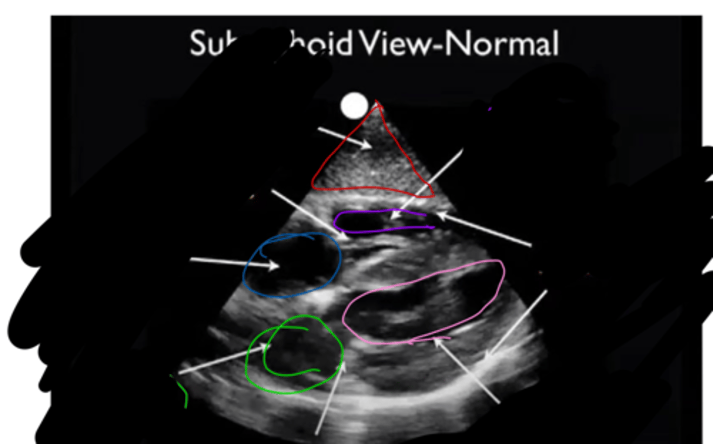 <p>identify the pink circle area</p>