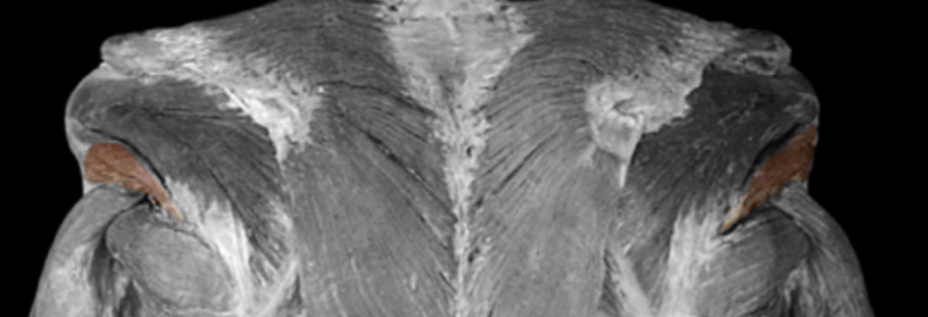 <p>What is this muscle?</p>