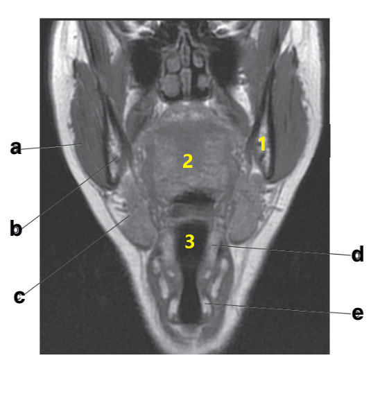 <p>What is letter c?</p>