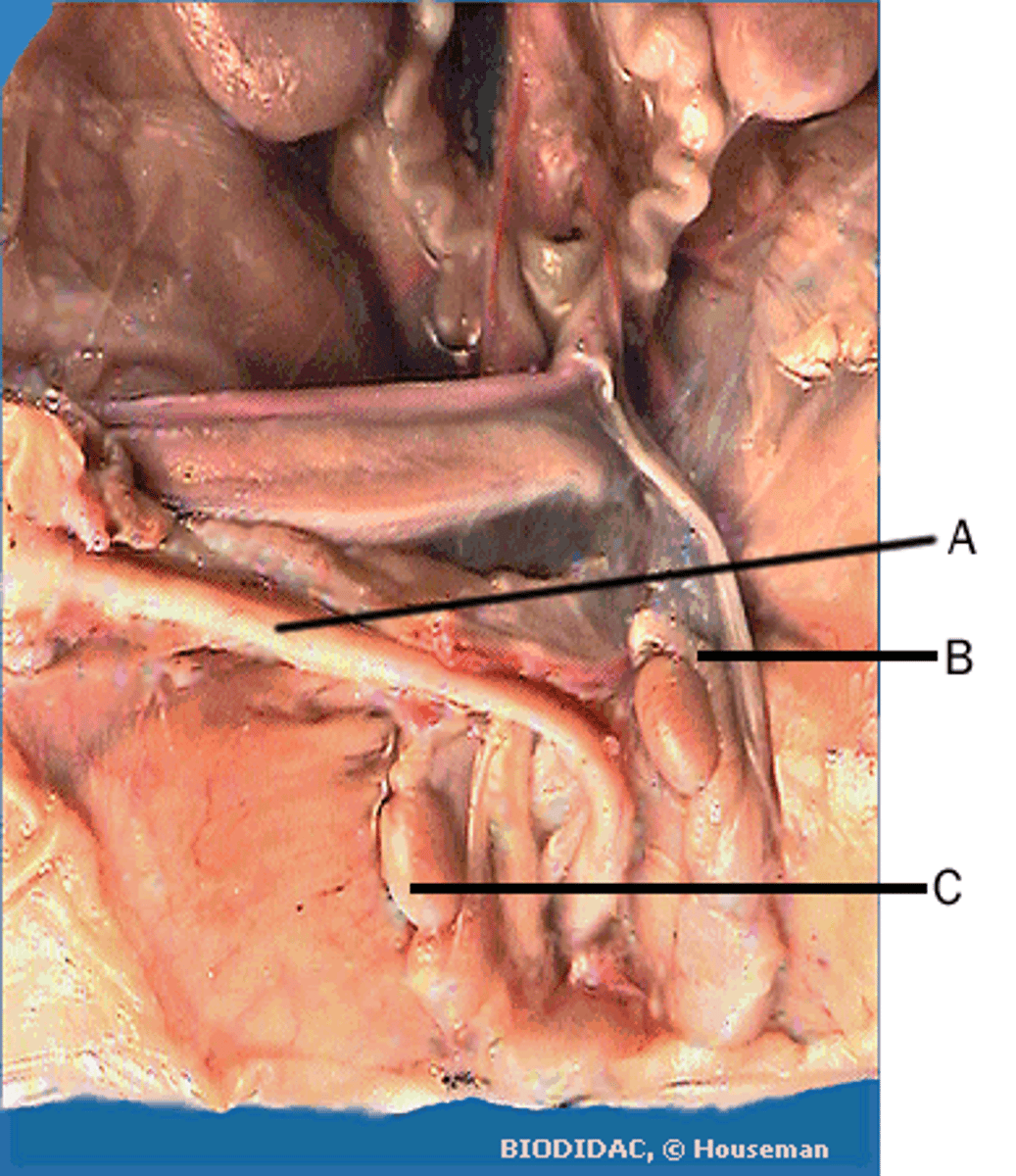 <p>C</p>