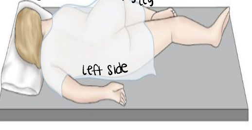 <p>left side for rectal temp and enemas → laying on left side with right leg bent</p>