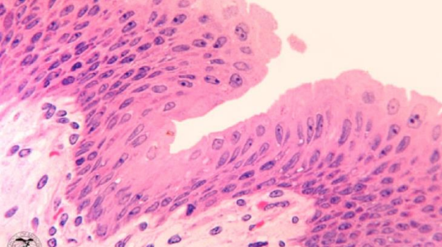 <p>transitional epithelial tissue</p>