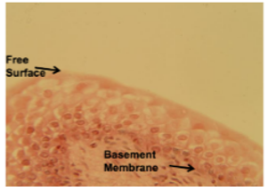 <p>structure: looks like stacks of cuboidal cells when in relaxed state, layers closest to apical surface can distend as bladder fills</p><p>location: bladder, urethra, ureters</p><p>function: allows stretching of urinary bladder as it fills</p>