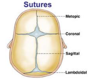 <p>Sutures </p>