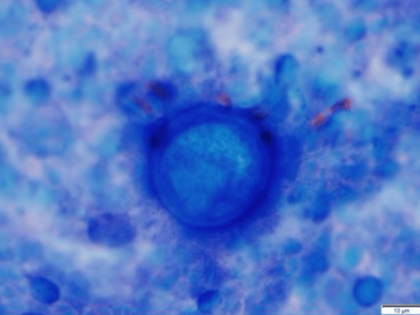 <p>Identify the organism and the size?</p>