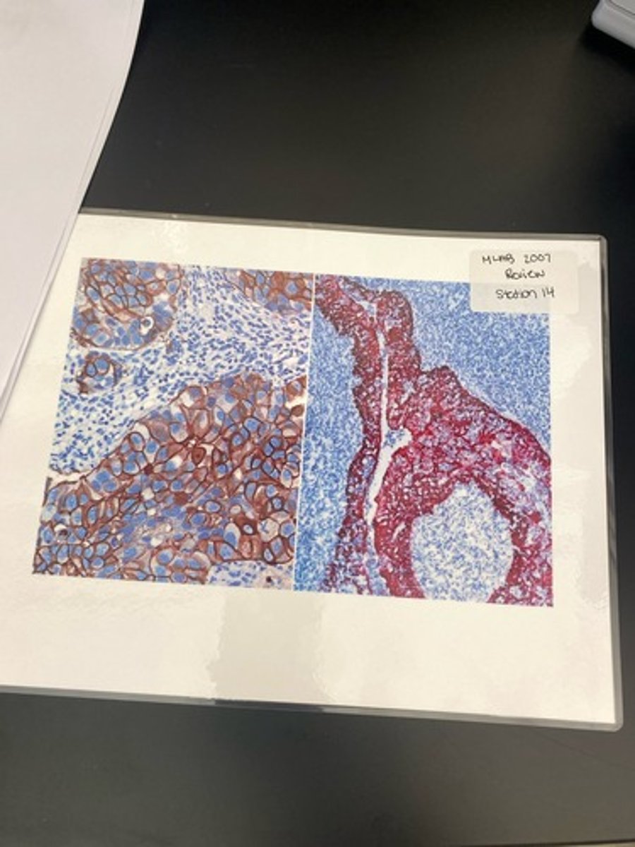 <p>What stain is this?</p>