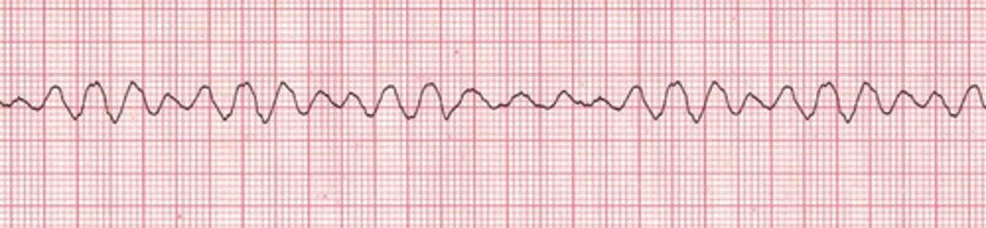<p>administer a second shock.</p>