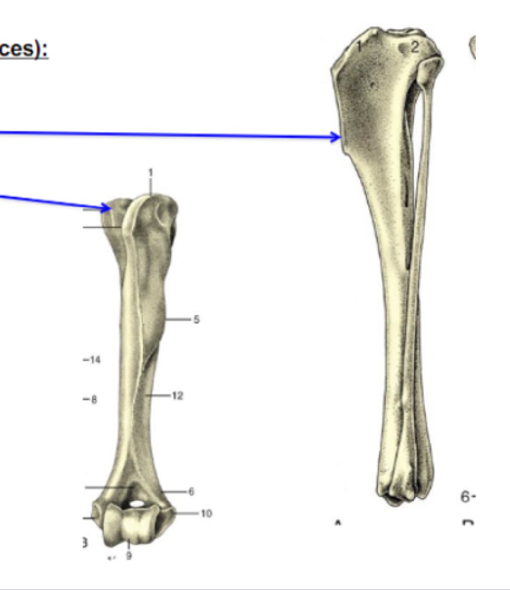 <p>Bone elevations</p><p>What is the TOP blue arrow pointing to?</p><p>3 multiple choice options</p>