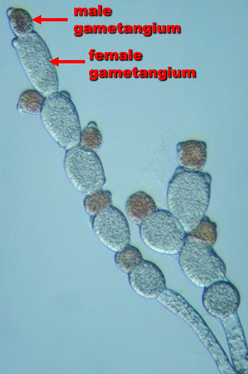 <p>what reproductive structures are present here </p>