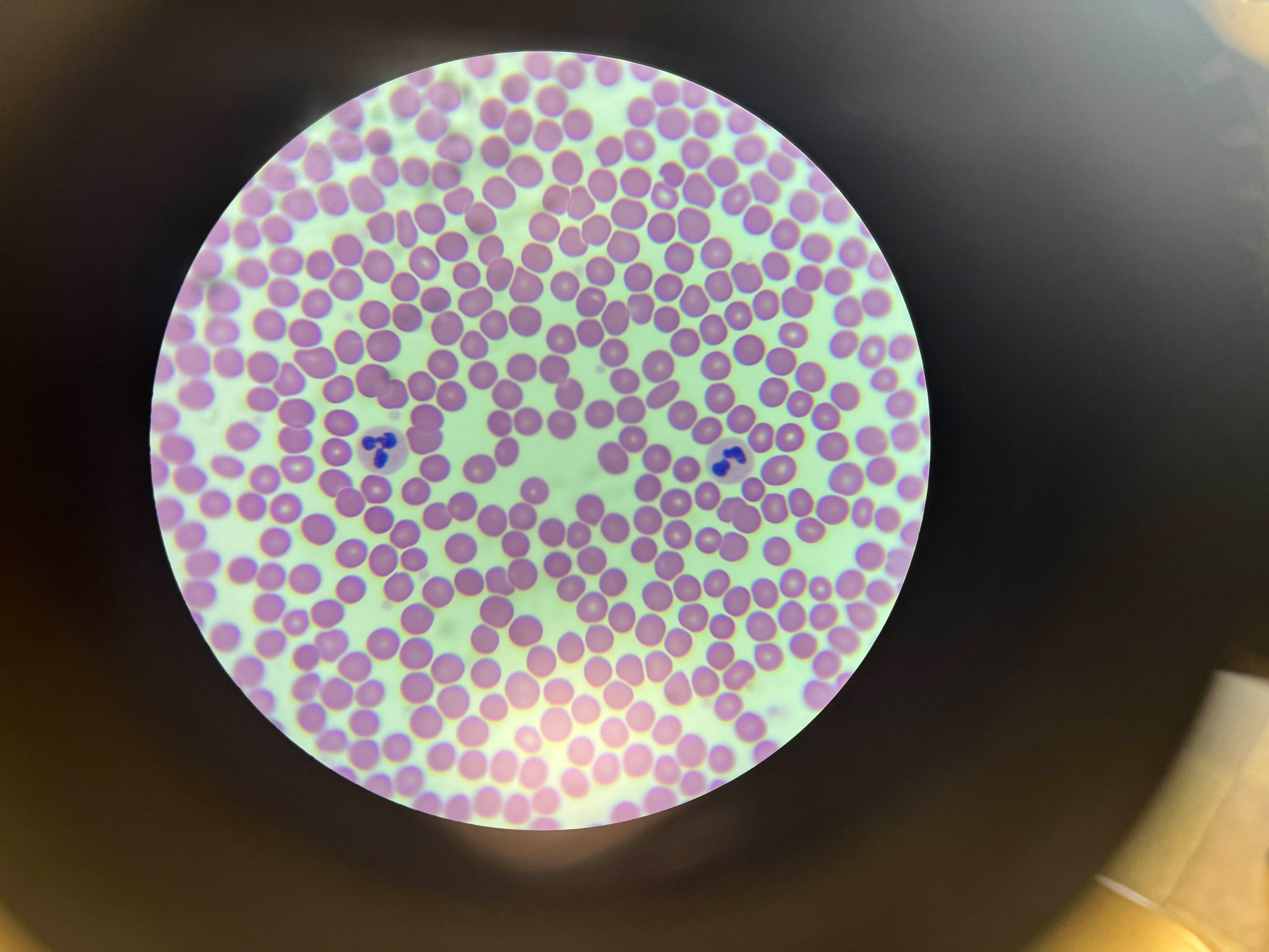 <p>Phagocytizes bacteria. Most abundant of WBCs</p>