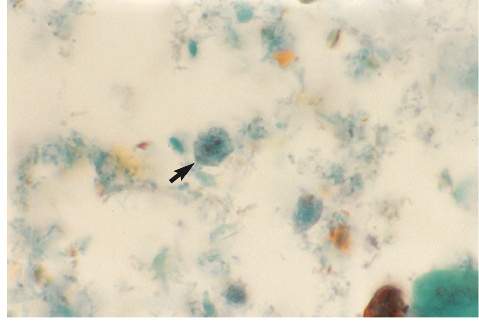 <p>An intestinal parasite.</p>