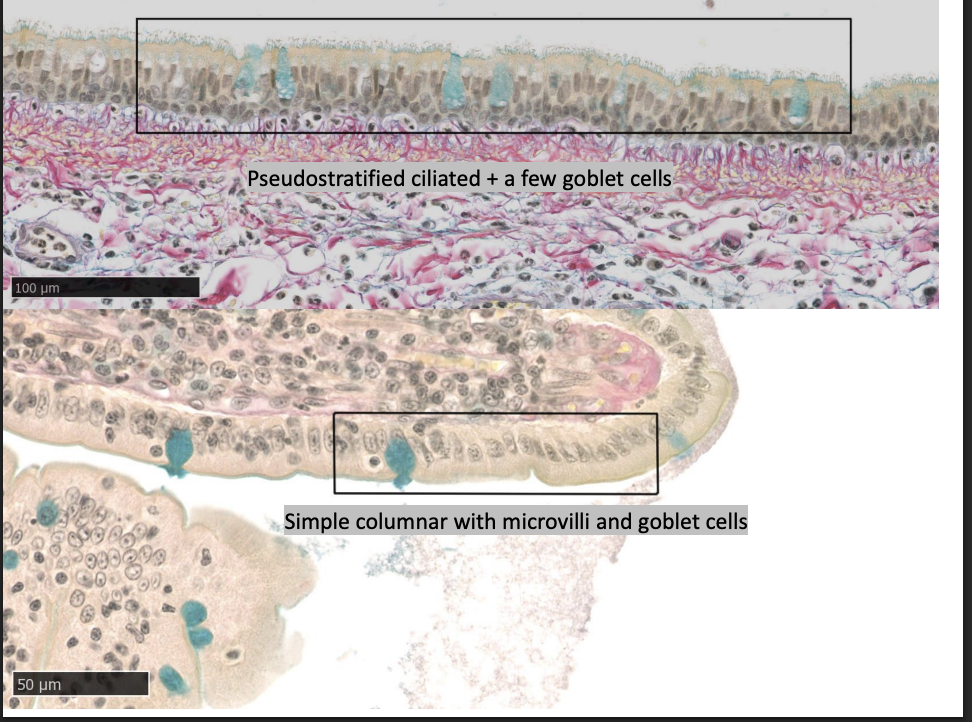 <ol><li><p>cover body surfaces</p></li><li><p>line body cavities</p></li><li><p>form solid glands→ e.g salivary glands</p></li></ol><p></p><p>Layers:</p><ol><li><p>Simple</p></li><li><p>stratified</p></li><li><p>pseudostratified (simple but seems 2+ layers)</p></li><li><p>Transitional (found in urinary system→ appearance changes if stretched/unstretched)</p></li></ol><p>Shape</p><ol><li><p>Squamous</p></li><li><p>Cuboidal</p></li><li><p>Columnar</p></li></ol><p>Modifications</p><ol><li><p>cilia</p></li><li><p>microvilli</p></li><li><p>secretory bodies (mucus droplets, secretory granules)</p></li></ol><p></p>