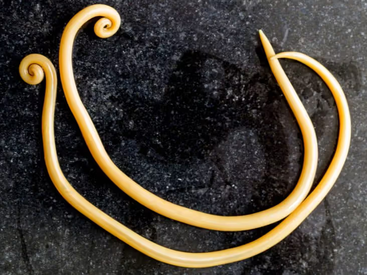 <p>Identify the phylum and genus of this animal</p>